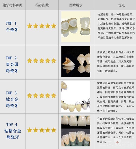 >>>快速咨询进入挂号中心每种镶牙材料的具体价格   